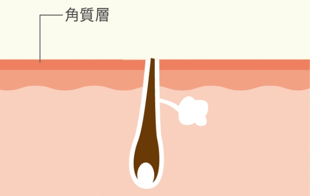 脱毛前に肌表面の毛をシェービングする流れ
